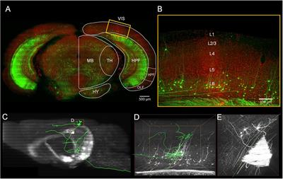 Pinpointing Morphology and Projection of Excitatory Neurons in Mouse Visual Cortex